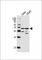 NFIC Antibody (Center)